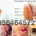 Artikel ZAITOP dan AMBEJOSS Obat Wasir Ambeien thumbnail