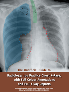 unofficial guide to x rays