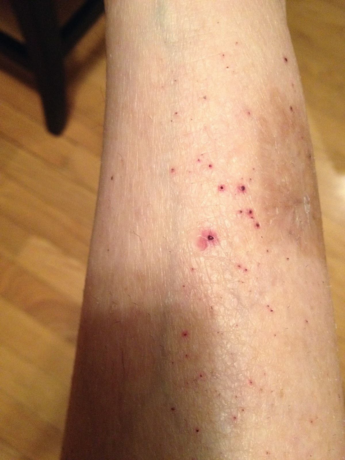 Asthma and the Gift of Running Overtraining, health issues and finding my way back!!