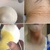 REMOVE DIRT AND DARKNESS FROM YOUR NECK IN JUST 20 MINUTES!