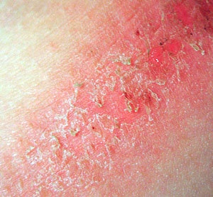 NOT CHANGING UNDIES? These are The Dangers Of Not Changing Your Underwear Daily NOT CHANGING UNDIES? These are The Dangers Of Not Changing Your Underwear Daily