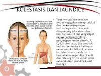 Image result for Kolestasis dan jaundice