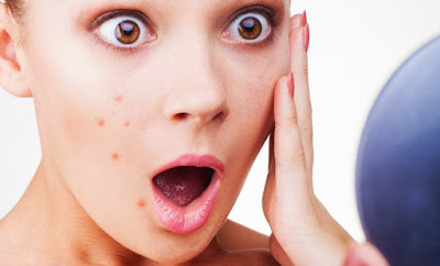 coisas para evitar pele acne adulta