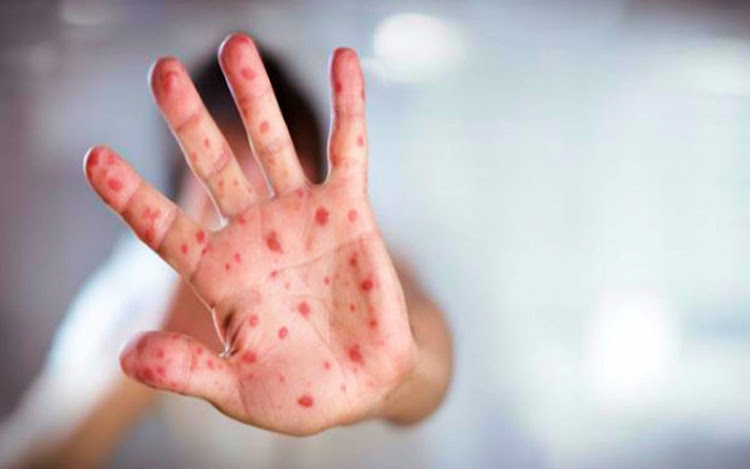 Paramixovirus Paramixovirus