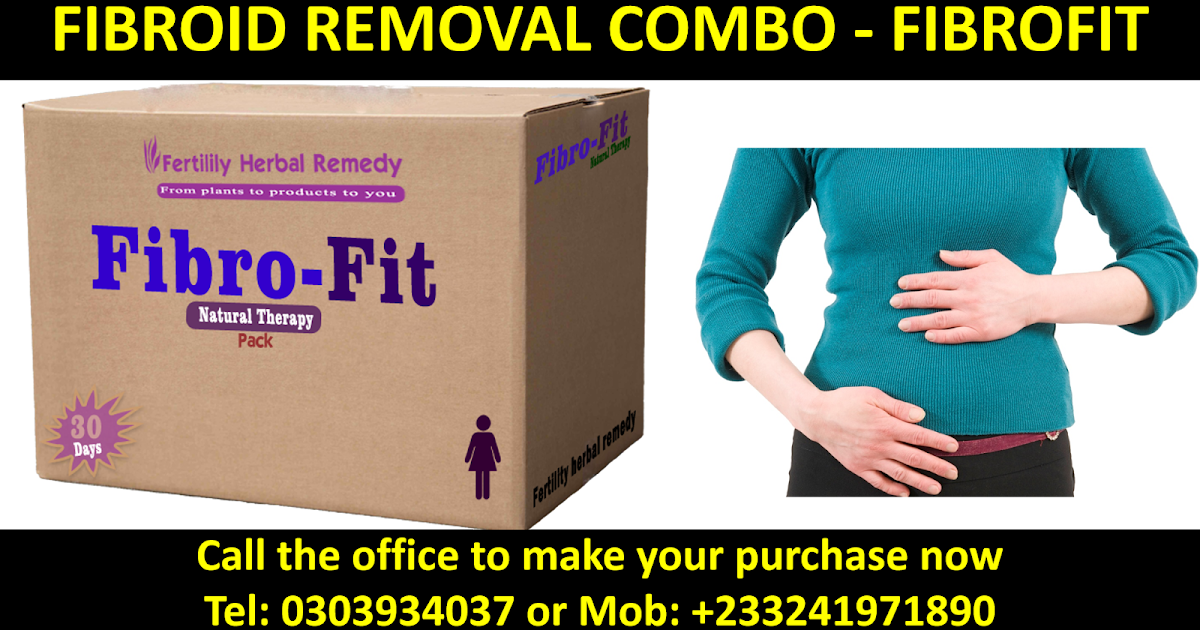 How to Remove Fibroids Without Surgery
