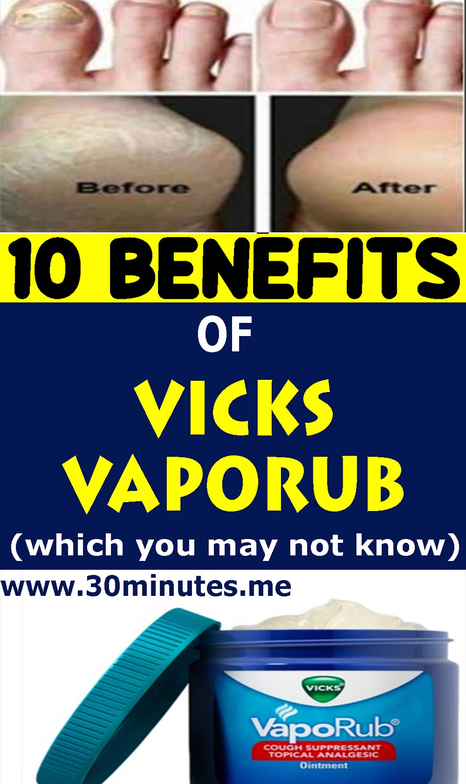 10 Benefits to Vicks VapoRub