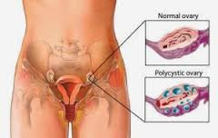 Vagina Gatal Dan Perih Vagina Gatal Dan Perih