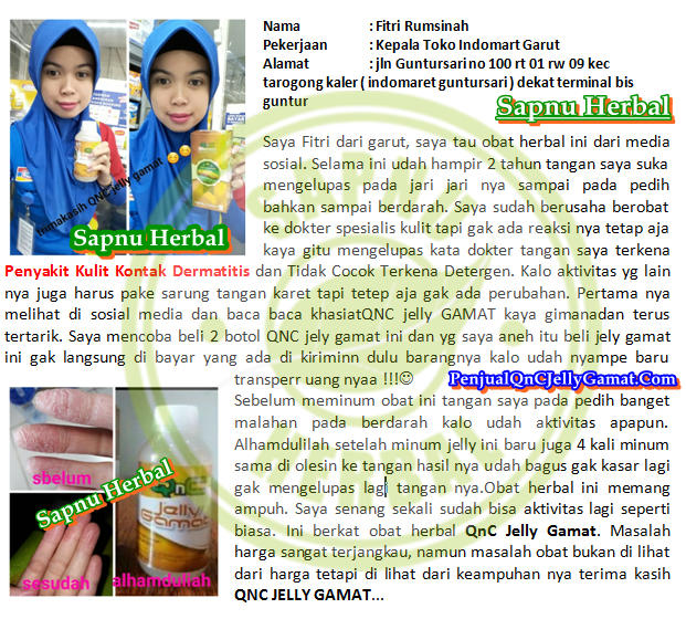 Cara Mengobati Biang Keringat di Belahan Payudara Secara Alami Cara Mengobati Biang Keringat di Belahan Payudara Secara Alami