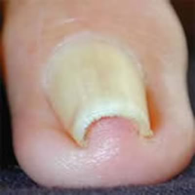Aprenda Manicure e Pedicure EM CASA online