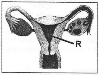 [Kunci Jawaban] Perhatikan gambar alat reproduksi wanita ...