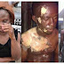 LADY POURS HOT WATER ON BABY DADDY BECAUSE OF DOMESTIC VIOLENCE (PHOTO)