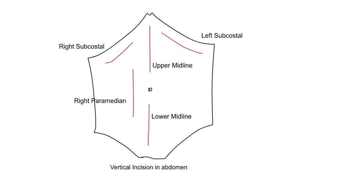 My notes Its How I graduated Medical School. Surgical Incision in abdomens.