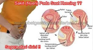 Foto Cara Alami Mengobati Sakit Saat Kencing Pada Wanita