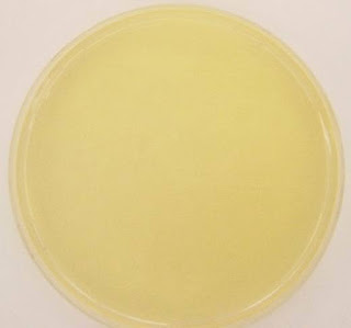 Medical Laboratory Technologist Media Nutrient Agar