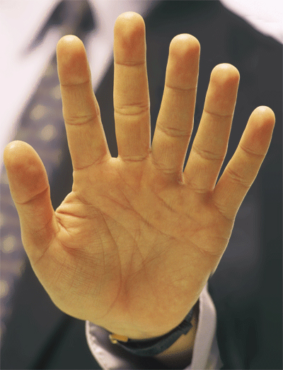 Image result for six fingered hand