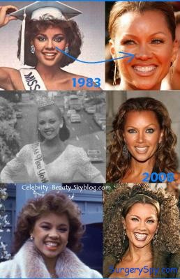 Vanessa Williams Plastic Surgery Before and After Botox and Nose Job