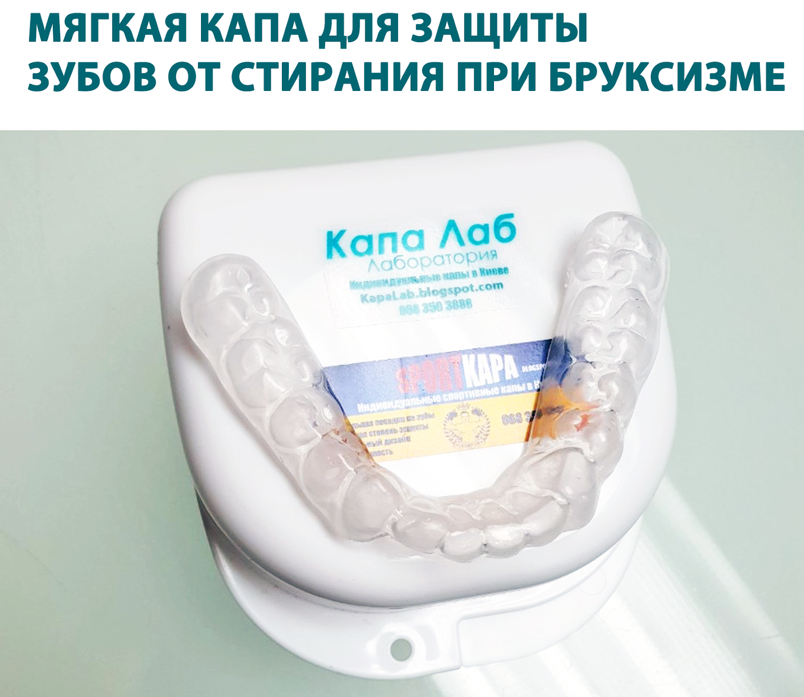 Капа для защиты зубов от стирания