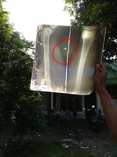 Kumpulan Foto Warga Saat Gerhana Matahari di Gresik 7 gerhana%2Bmatahari%2Blowayu