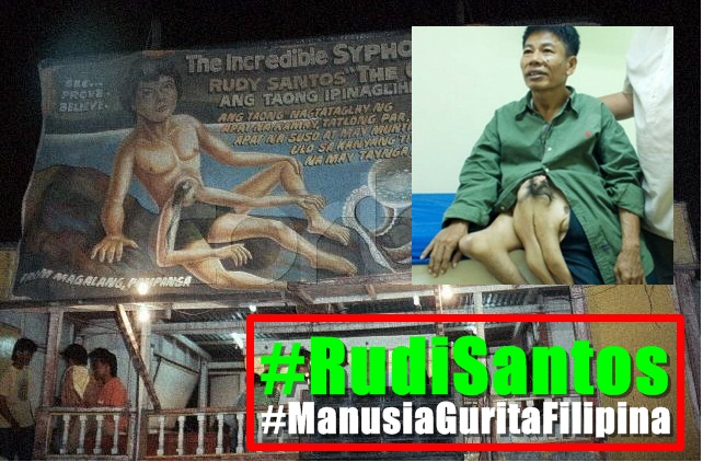 Empat Manusia Bertubuh Fisik Seperti Hewan Paling Aneh di Dunia Empat Manusia Bertubuh Fisik Seperti Hewan Paling Aneh di Dunia