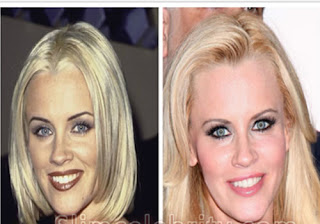 Nice Plastic Surgery