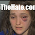 Student beaten on train; gets unfortunate lesson on diversity