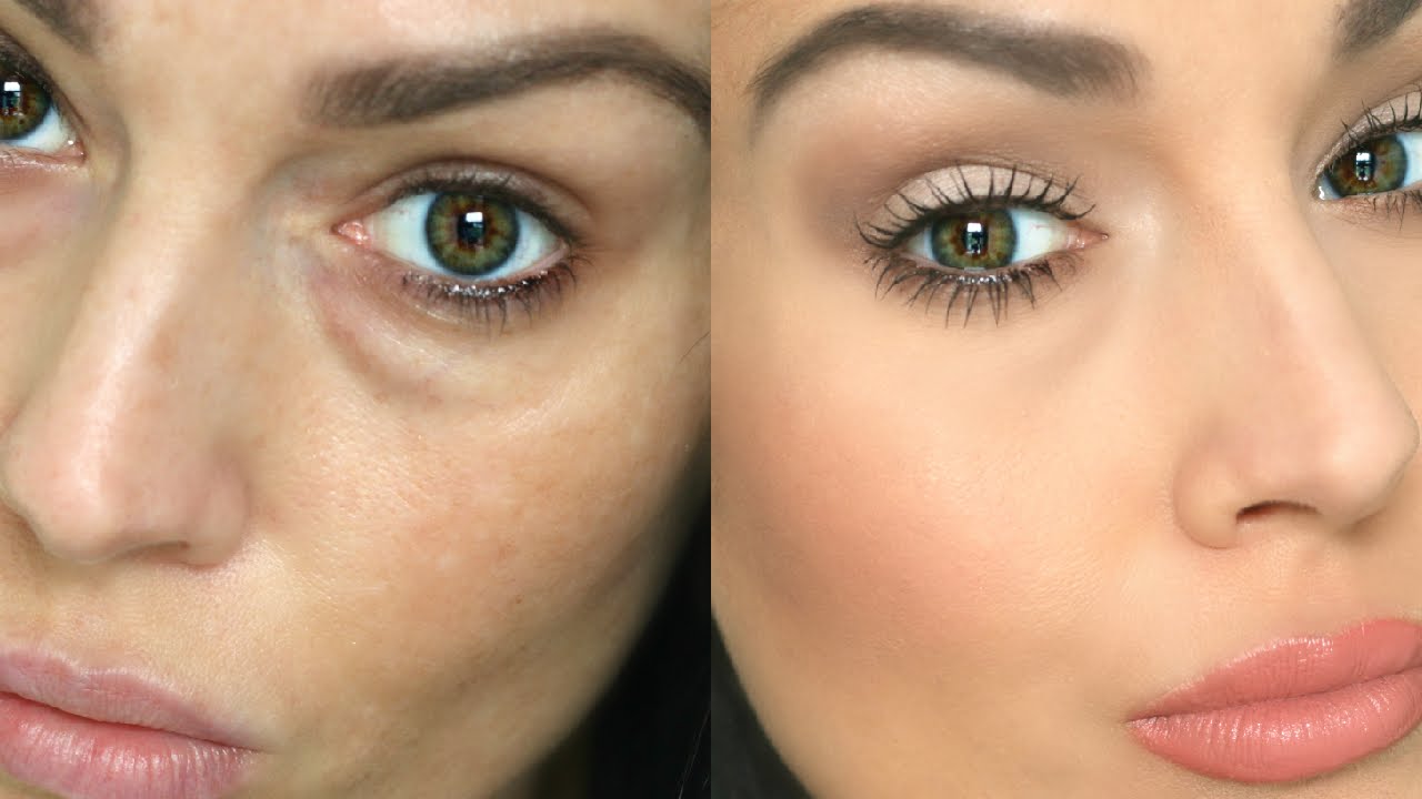 O que causa círculos escuros sob seus olhos?
