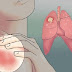 20 EARLY WARNING SIGNS OF LUNG CANCER THAT WOMEN SHOULD NEVER IGNORE