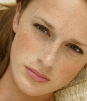 How To Lighten Pigmentation On Face Naturally How To Lighten Pigmentation On Face Naturally