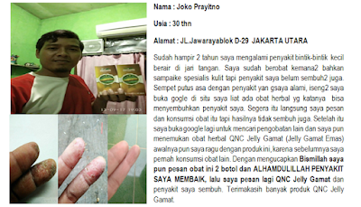 Obat Karurawit / Karurawit Herbal Obat Karurawit / Karurawit Herbal