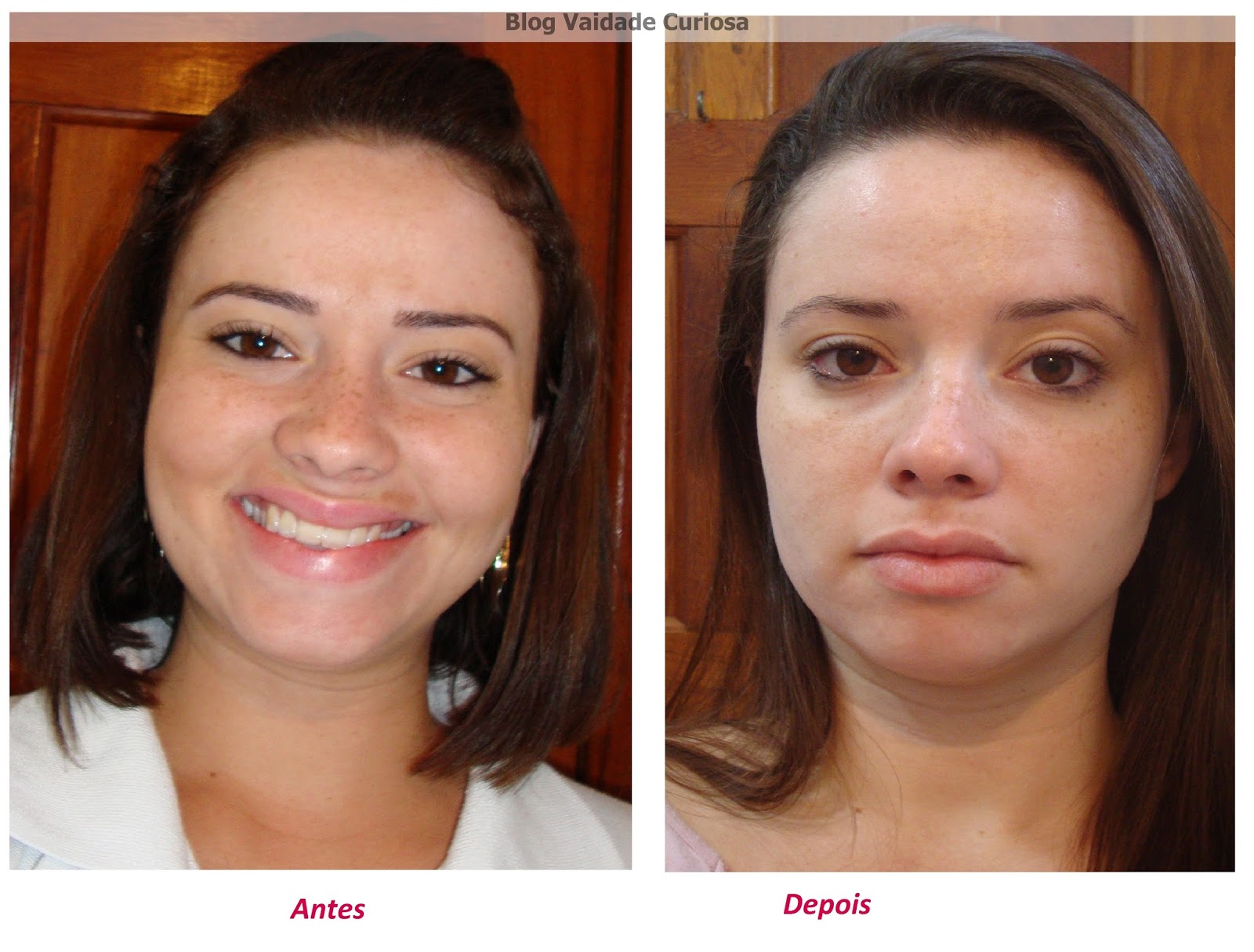 Resultado do Vitacid Plus - Vaidade Curiosa