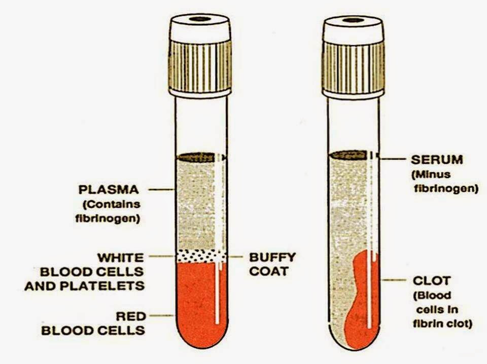 Perbedaan Serum Dan Plasma MedTech perbedaan-serum-dan-plasma-medtech