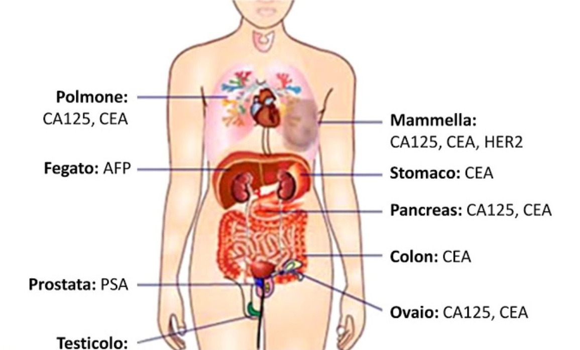 markeri tumorali prostata)