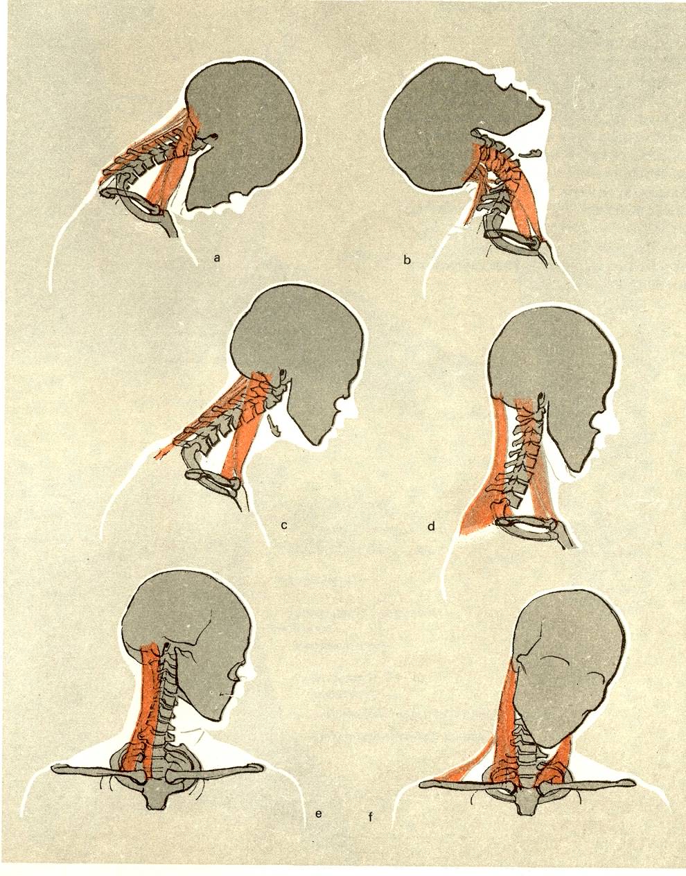 И имя мне Слэшер
