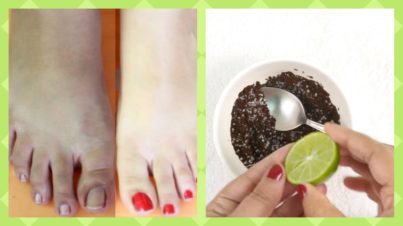 How To Lighten Skin On Feet At Home Fashionr