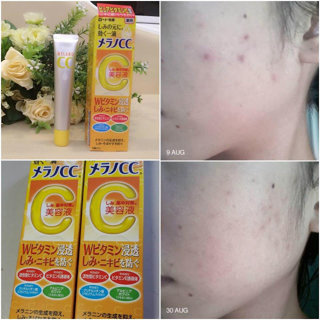 cảm nhận sử dụng sản phẩm Melano CC đánh giá review sản phẩm Melano CC