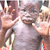 Monkey Pox hits Delta state, six suspected cases recorded