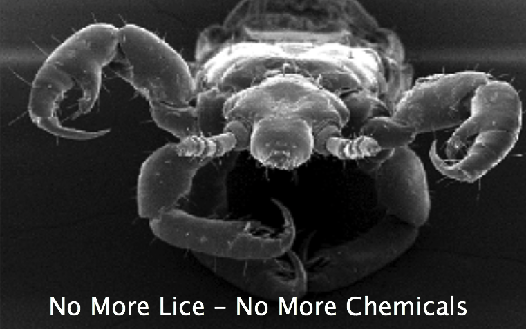 No More Lice - No More Chemicals