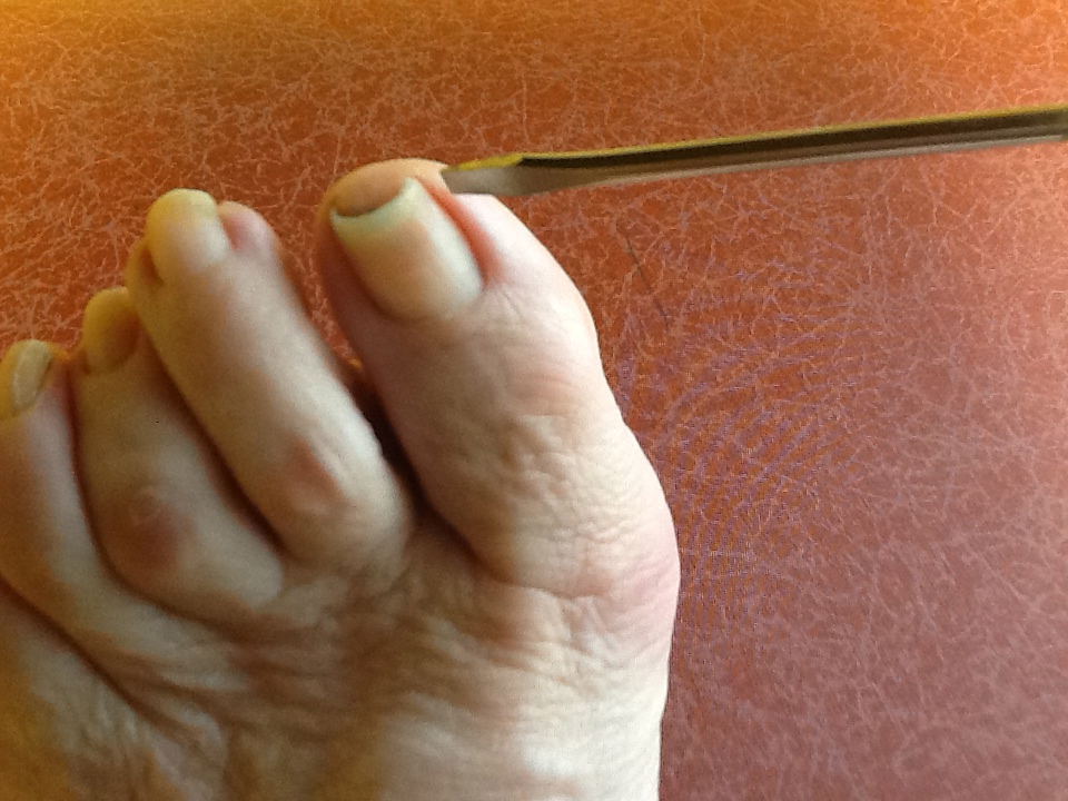 Foot and Ankle Problems By Dr. Richard Blake: Why do toenails become more  curved as we Age?