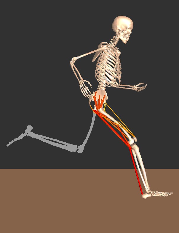 A Runners Progress Hamstring Tendinopathy A case of longterm management