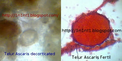 specifikus immunglobulin e ascaris esetén