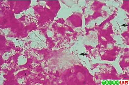 gram negative preparation fluid amniotic atlas microbiology bacillary direct stain examination infections selected fig