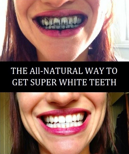 The AllNatural way to get super white teeth at home How To Beauty
