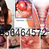 Cara Mengobati Ambeien Luar di Dekat Vagina thumbnail