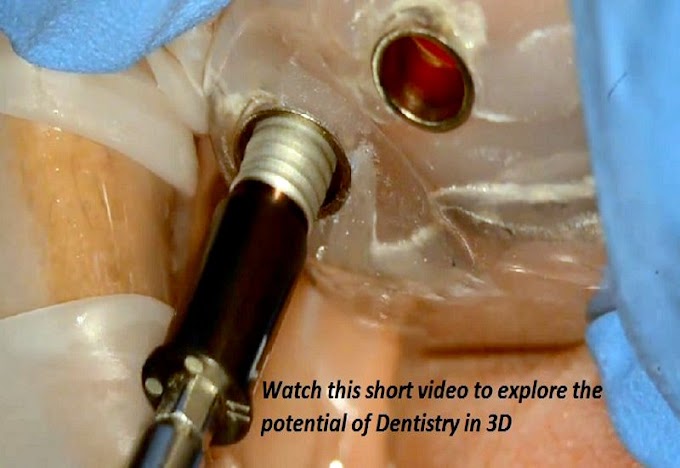 IMPLANTOLOGY: Discussing guided dental implants and CAD-RAY Imaging Centers