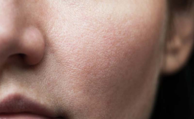 Why do diseases smell?