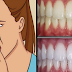 How to Eliminate Bad Breath Permanently and Whiten Your Teeth Fast With Simple Home Remedies