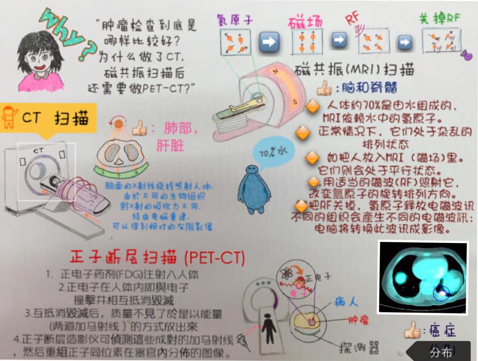 Radiotherapy Differences Between a CT Scan, PETCT Scan, and MRI Scan