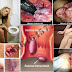 Seks Lewat Anus Rentan Kena Penyakit Kelamin dan Wasir thumbnail