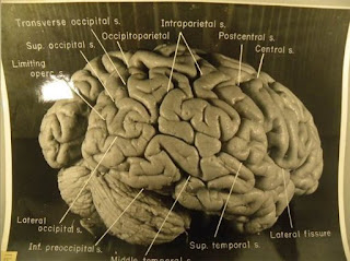 Otak Albert Einstein