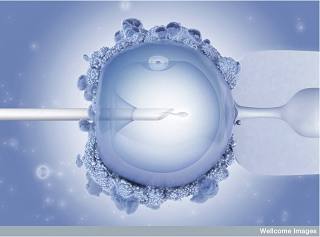 Image: Intracytoplasmic Sperm Injection